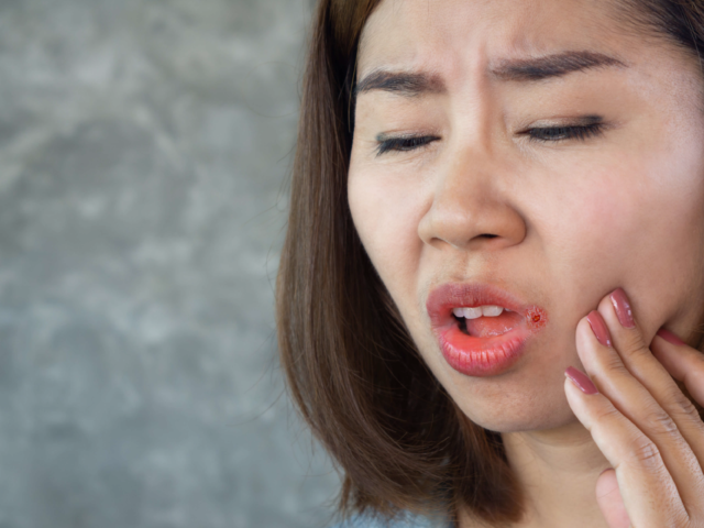 Do Opioids Cause Dry Mouth?